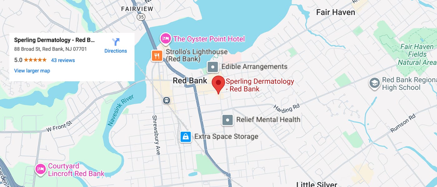 Sperling Dermatology Red Bank Location