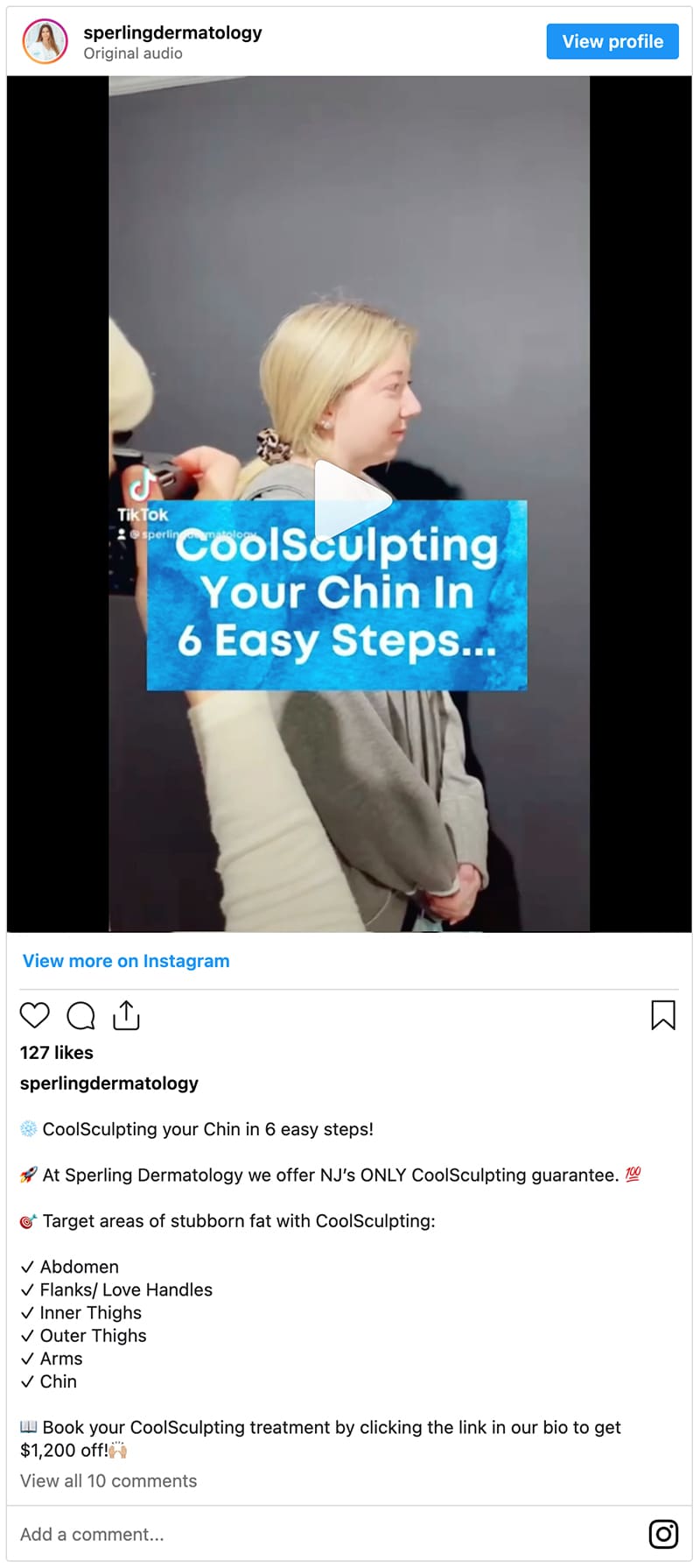 CoolSculpting Elite New Jersey Instagram