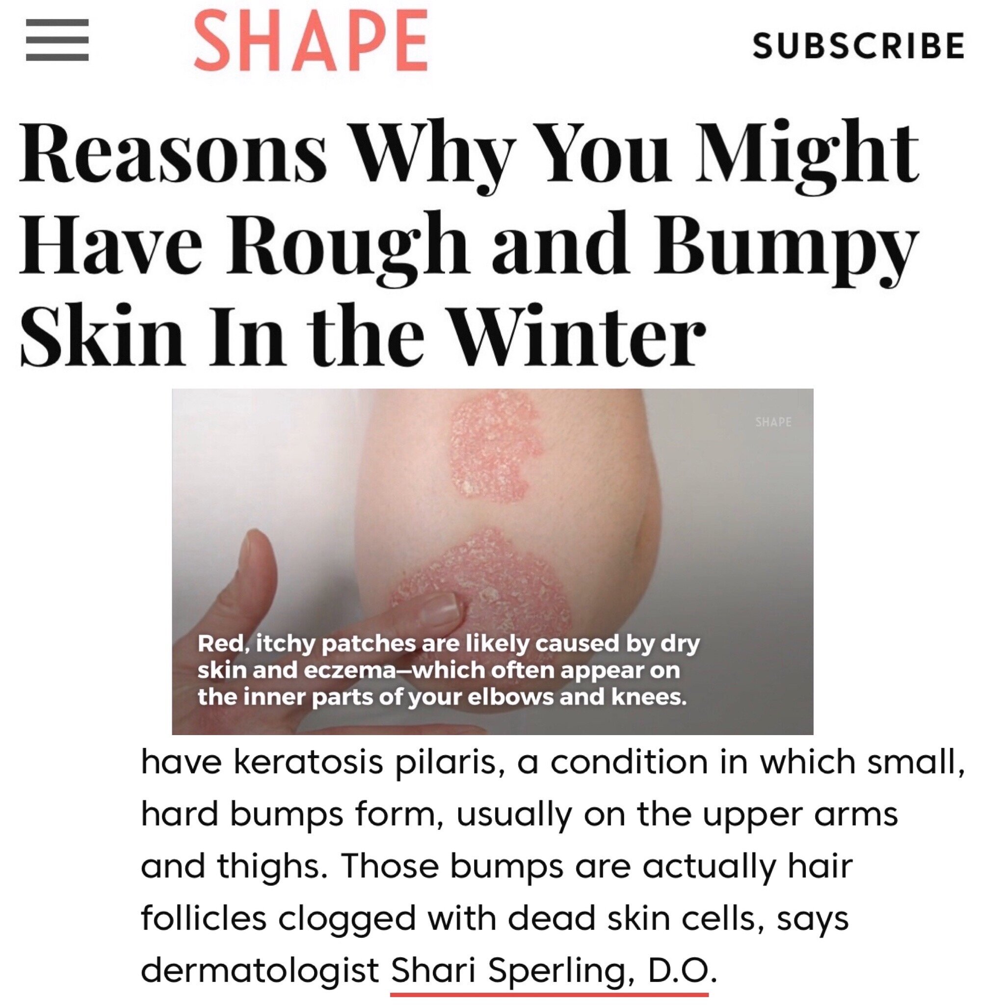 Sperling Dermatology featured in Shape